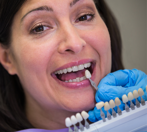 Conserto de prótese dentária